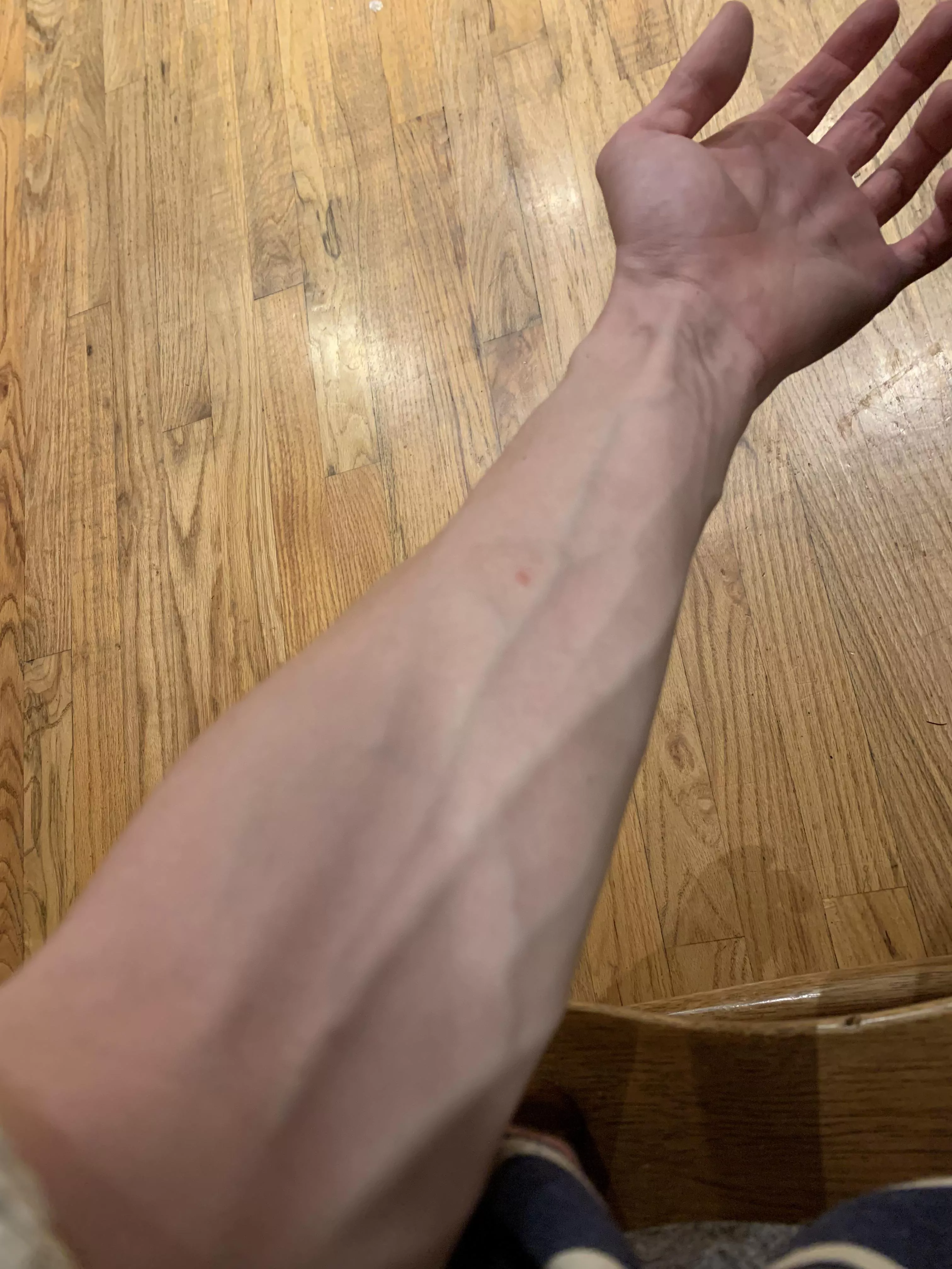 Veins for daysâ€¦