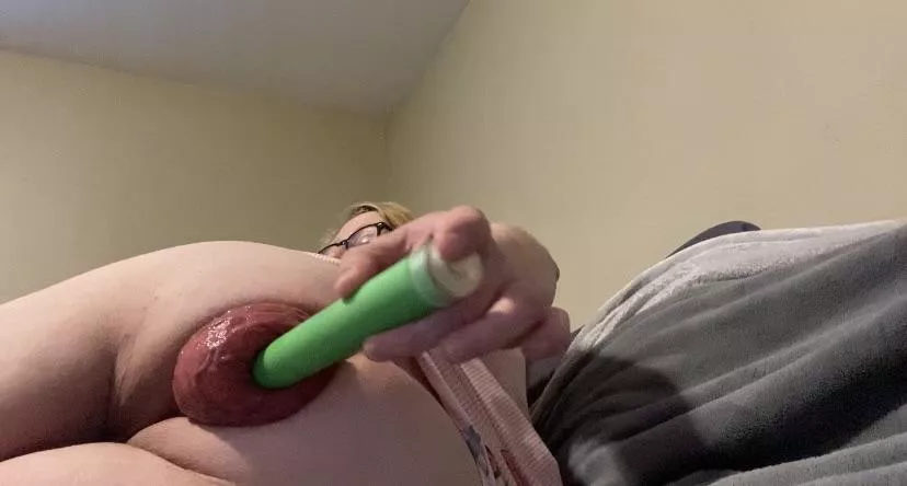 Vibrator in my anal prolapse