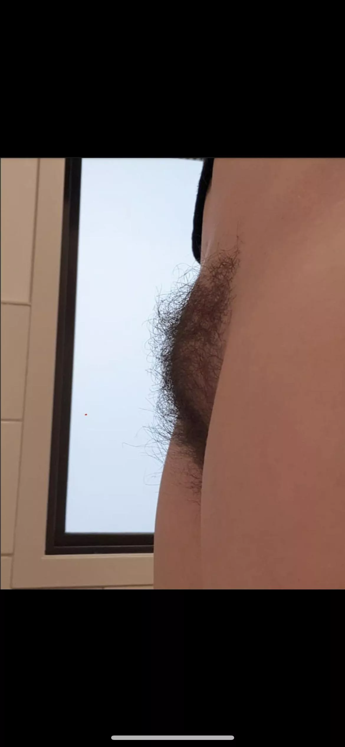 What do you think of a hairy mound?