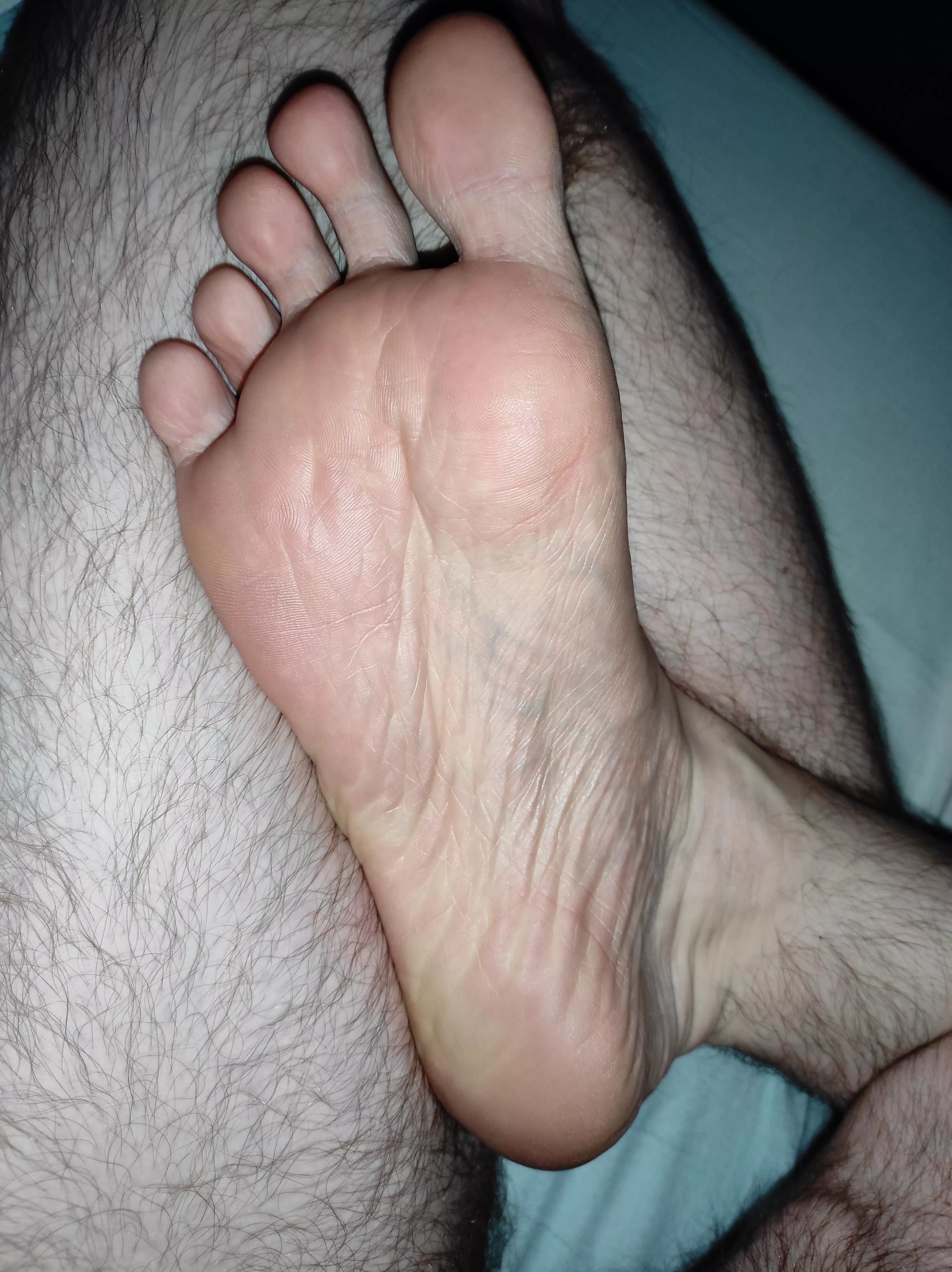 Who likes their feet smelly?